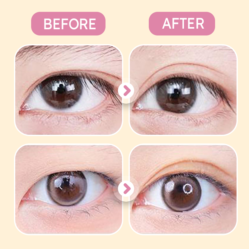 Invisible Strong Support Double Eyelid Tapes for Enlarging Eyes