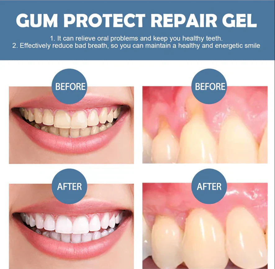 📢📢50% off!!⏰ Gum Protection Repair Gel 🦷