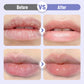 Plumping and moisturizing lip serum against wrinkles
